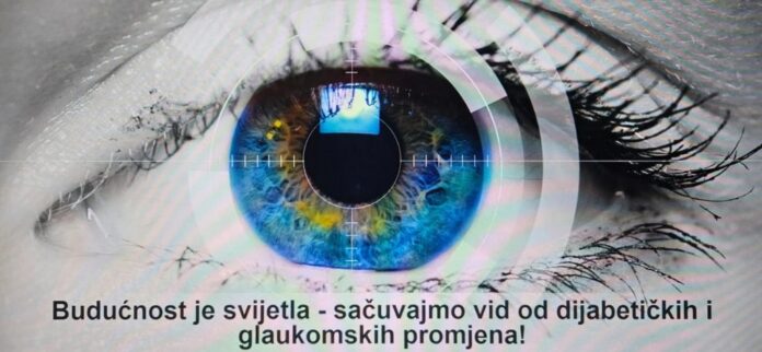 svjetski tjedan glaukoma